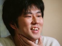 Eiichiro Oda revela o motivo por trás da cicatriz na boca de
